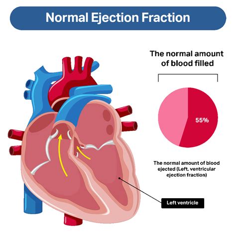 heart failure with reduced ejection fraction treatment.